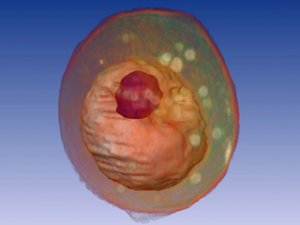  Saccharomyces cerevisiae   .      ( ) ( NIH)