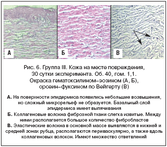 . 6.  III.    , 30  . . 40, . 1,1.  - (, ), -   ()