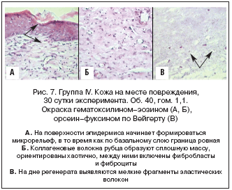 . 7.  IV.    , 30  . . 40, . 1,1.  - (, ), -   ()