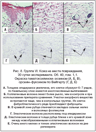 . 8.  VI.    , 30  . . 40, . 1,1.  - (, , ), -   (, , )