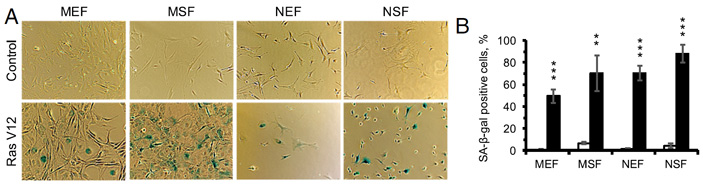 Рис. 4. Результаты β-галактозидазного окрашивания в культуре фибробластов