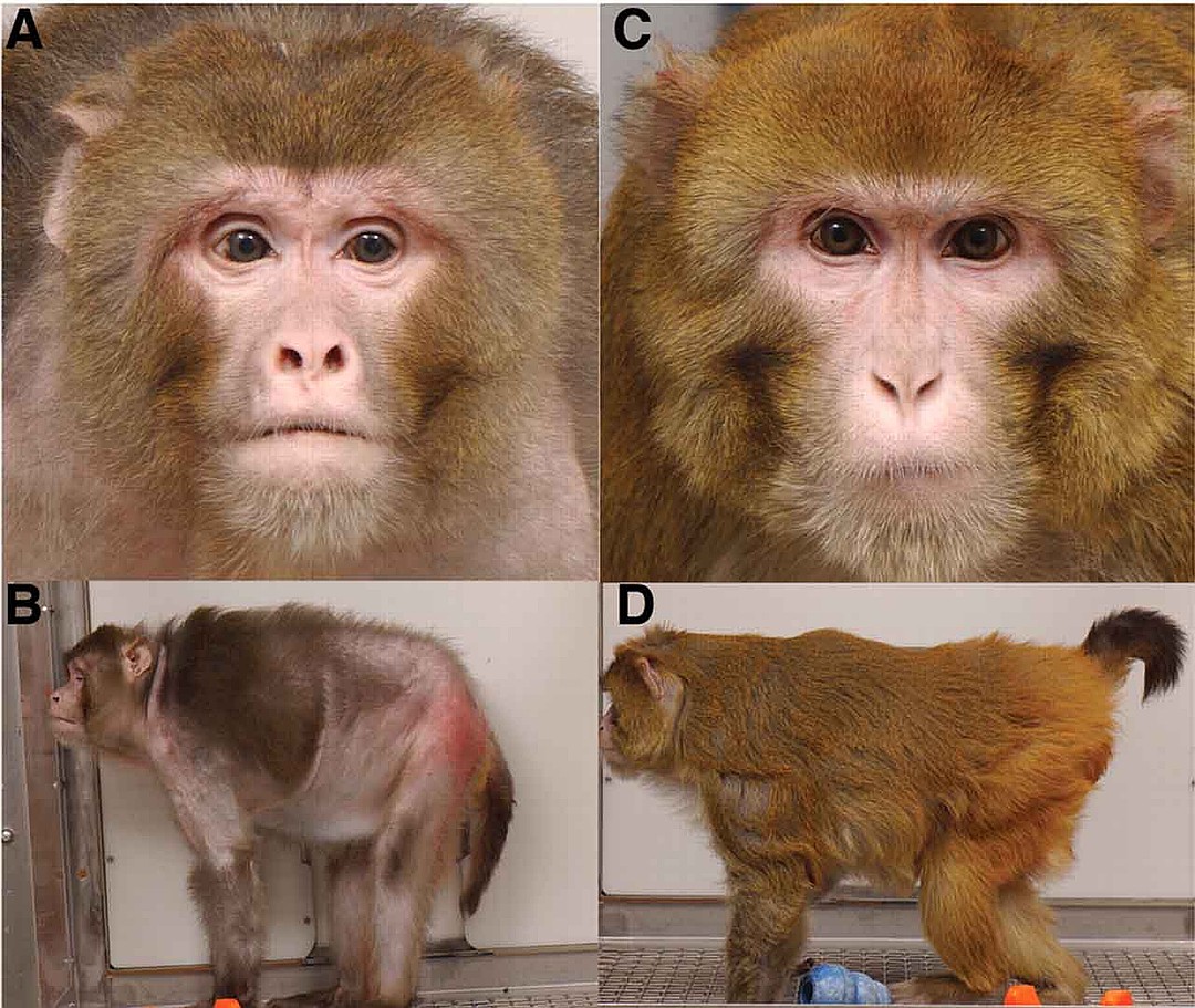   -     (  )     . : Science. 2009 Jul 10;325(5937):201-4. Colman RJ, Anderson RM, Johnson SC, et al. Caloric restriction delays disease onset and mortality in rhesus monkeys 