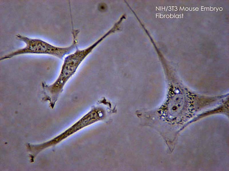Фибробласты эмбриона мыши под микроскопом