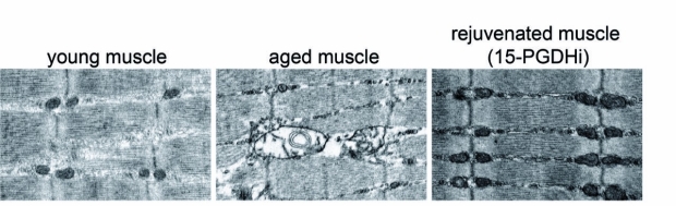 young, old and rejuvenated mouse muscle